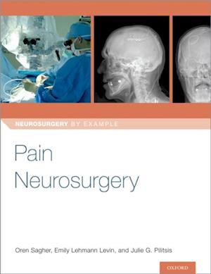 Pain Neurosurgery