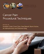 Cancer Pain Procedural Techniques