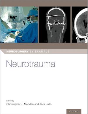 Neurotrauma