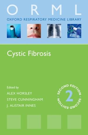 Cystic Fibrosis