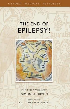 End of Epilepsy?