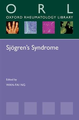 Sjogren's Syndrome