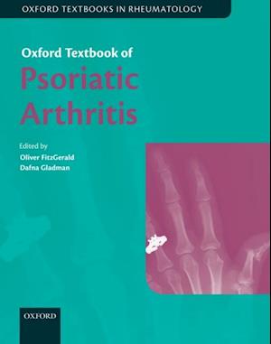 Oxford Textbook of Psoriatic Arthritis