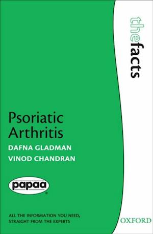 Psoriatic Arthritis