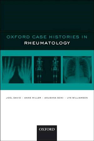 Oxford Case Histories in Rheumatology