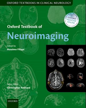 Oxford Textbook of Neuroimaging