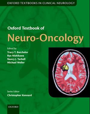 Oxford Textbook of Neuro-Oncology