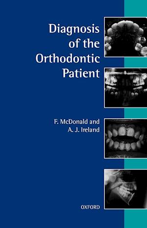 Diagnosis of the Orthodontic Patient