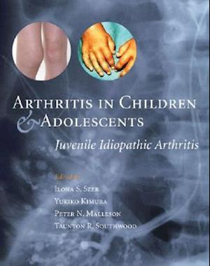 Arthritis in Children and Adolescents