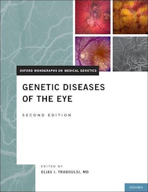Genetic Diseases of the Eye