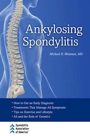 Ankylosing Spondylitis