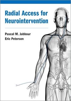 Radial Access for Neurointervention