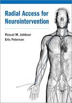 Radial Access for Neurointervention