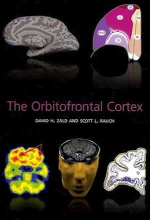 The Orbitofrontal Cortex