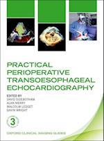 Practical Perioperative Transoesophageal Echocardiography