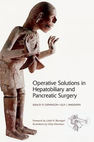 Operative Solutions in Hepatobiliary and Pancreatic Surgery