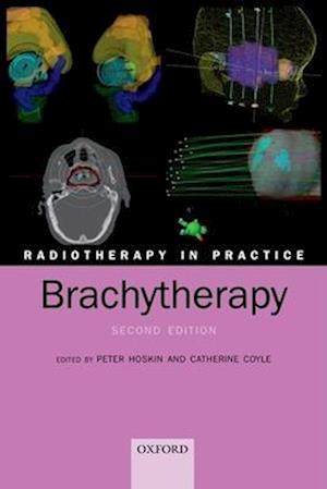 Radiotherapy in Practice - Brachytherapy