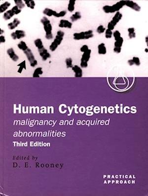 Human Cytogenetics: Malignancy and Acquired Abnormalities