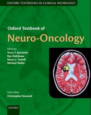 Oxford Textbook of Neuro-Oncology