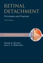 Retinal Detachment