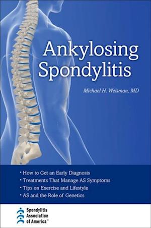 Ankylosing Spondylitis