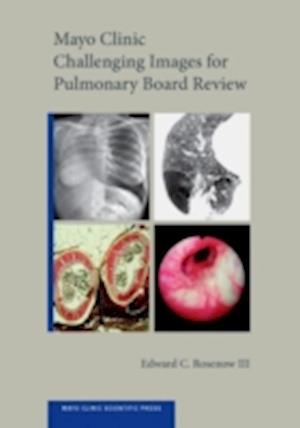 Mayo Clinic Challenging Images for Pulmonary Board Review