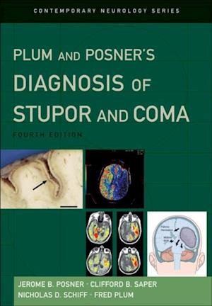 Plum and Posner's Diagnosis of Stupor and Coma