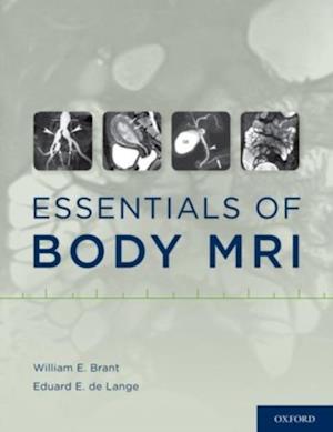 Essentials of Body MRI