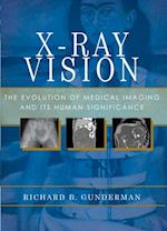 X-Ray Vision