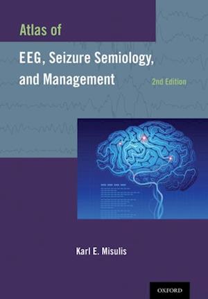 Atlas of EEG, Seizure Semiology, and Management