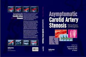 Asymptomatic Carotid Artery Stenosis