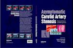 Asymptomatic Carotid Artery Stenosis