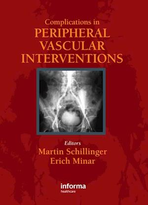 Complicatons in Peripheral Vascular Interventions