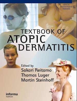 Textbook of Atopic Dermatitis