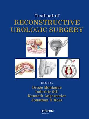 Textbook of Reconstructive Urologic Surgery