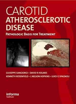 Carotid Atherosclerotic Disease