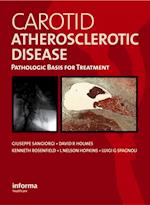 Carotid Atherosclerotic Disease