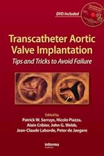 Transcatheter Aortic Valve Implantation