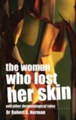 Woman Who Lost Her Skin