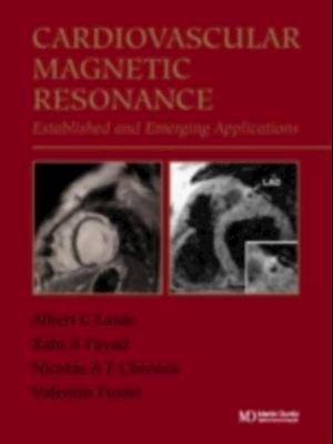 Handbook of Cardiovascular Magnetic Resonance Imaging