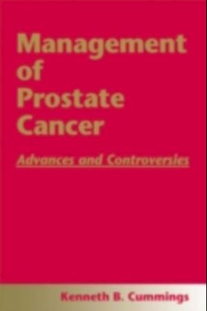 Management of Prostate Cancer