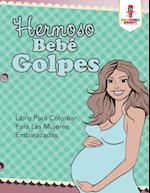 Hermoso Bebe Golpes