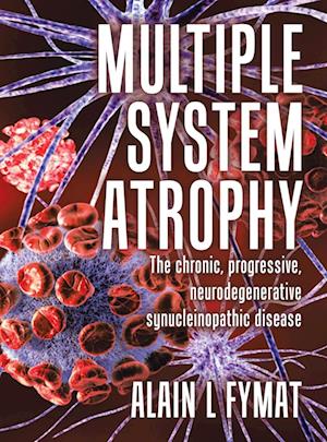 Multiple System Atrophy