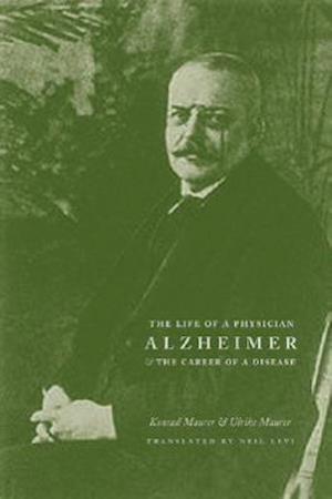 Alzheimer