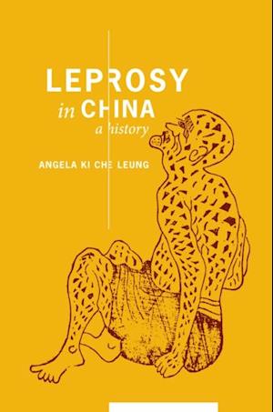 Leprosy in China