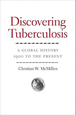 DISCOVERING TUBERCULOSIS