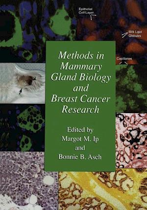 Methods in Mammary Gland Biology and Breast Cancer Research