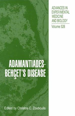 Adamantiades-Behcet's Disease