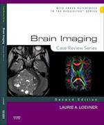 Brain Imaging: Case Review Series