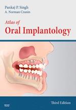 Atlas of Oral Implantology - E-Book